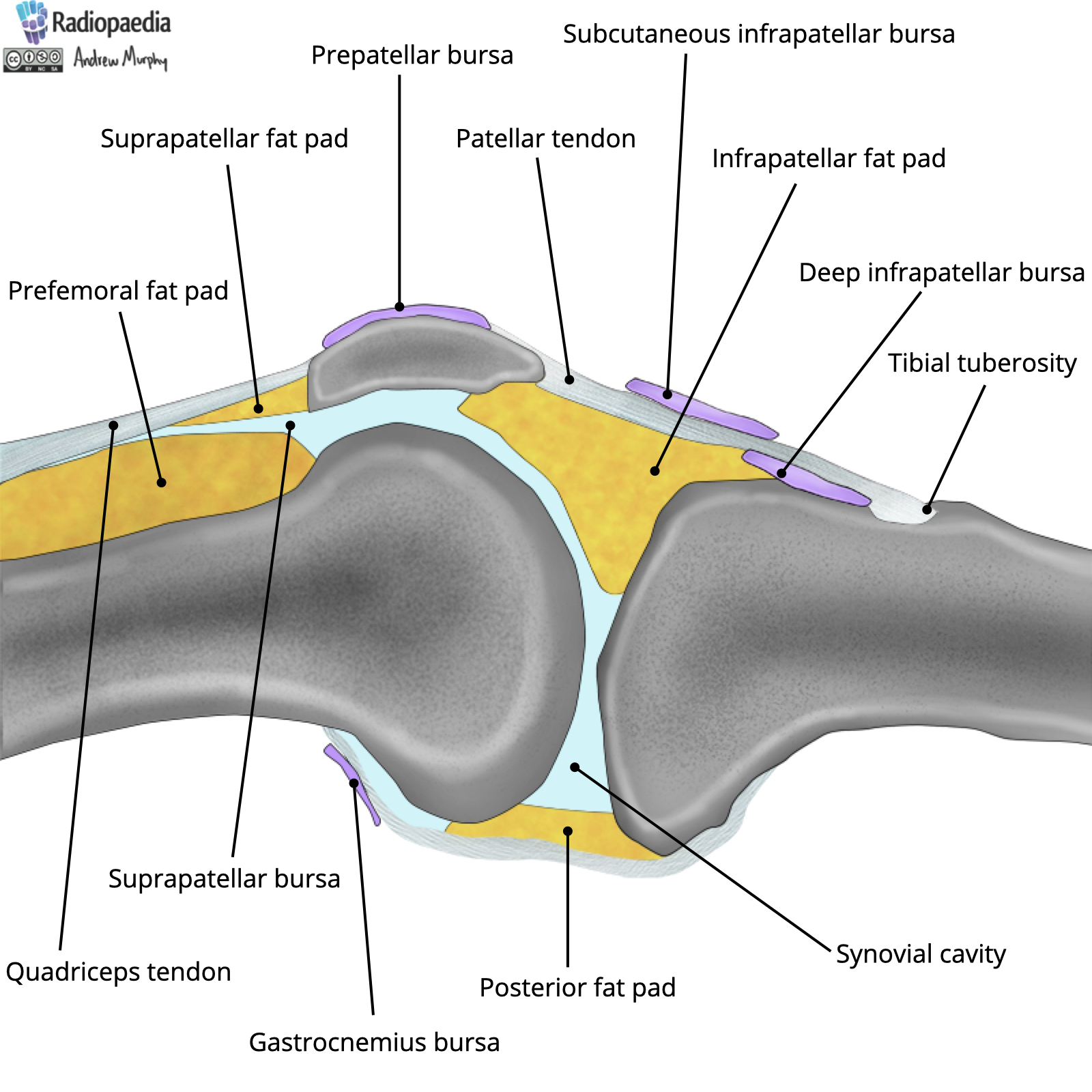 Radiopaedia Drawing Fat pads and bursae of the knee English labels